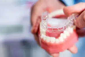 Invisalign treatment length