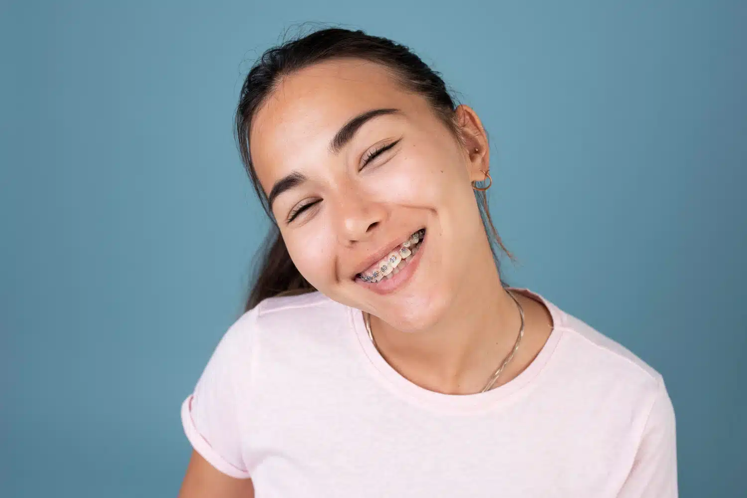 Orthodontic Treatment: 10 Vital Facts Every Patient Should Know